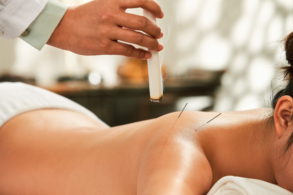 The doctor of traditional Chinese medicine moxibustion and acupuncture
